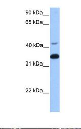 Fetal brain lysate. Antibody concentration: 1.0 ug/ml. Gel concentration: 12%.