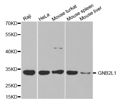 Western blot analysis of extracts of various cell lines, using GNB2L1 antibody.