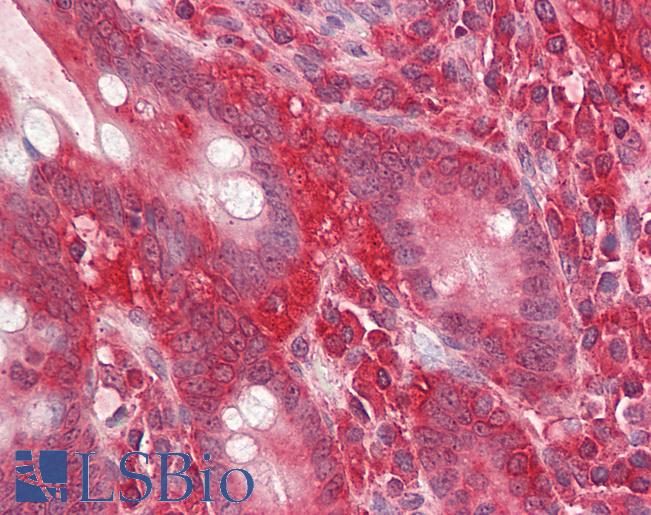 Anti-GNB2L1 / RACK1 antibody IHC of human small intestine. Immunohistochemistry of formalin-fixed, paraffin-embedded tissue after heat-induced antigen retrieval. Antibody LS-B8352 dilution 3.75 ug/ml.