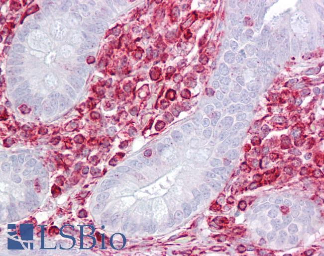 Anti-RACK1 antibody IHC of human small intestine. Immunohistochemistry of formalin-fixed, paraffin-embedded tissue after heat-induced antigen retrieval. Antibody LS-B6818 concentration 5 ug/ml.