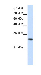 GNB2L1 / RACK1 antibody LS-B1534 Western blot of Jurkat lysate.