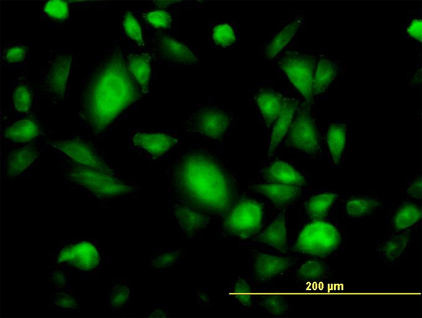 Immunofluorescence of monoclonal antibody to GNB3 on HepG2 cell. [antibody concentration 10 ug/ml]