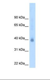 MCF7 cell lysate. Antibody concentration: 2.5 ug/ml. Gel concentration: 12%.