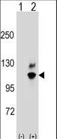 Western blot of GNL2 (arrow) using rabbit polyclonal GNL2 Antibody. 293 cell lysates (2 ug/lane) either nontransfected (Lane 1) or transiently transfected (Lane 2) with the GNL2 gene.