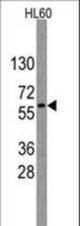Western blot of anti-GNL3 Antibody (RB13797) in HL60 cell line lysates (35 ug/lane). GNL3 (arrow) was detected using the purified antibody.