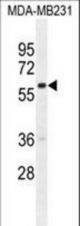 GNL3L Antibody western blot of MDA-MB231 cell line lysates (35 ug/lane). The GNL3L antibody detected the GNL3L protein (arrow).