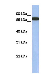 GNL3L antibody LS-C110923 Western blot of Fetal Lung lysate.