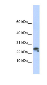 GNLY / Granulysin antibody LS-C110687 Western blot of Fetal Muscle lysate.