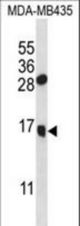 GNLY Antibody western blot of MDA-MB435 cell line lysates (35 ug/lane). The GNLY antibody detected the GNLY protein (arrow).