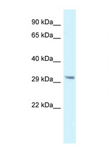 GNMT antibody LS-C145641 Western blot of Small Intestine lysate. Antibody concentration 1 ug/ml.