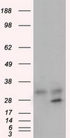 HEK293T cells were transfected with the pCMV6-ENTRY control (Left lane) or pCMV6-ENTRY GNMT (Right lane) cDNA for 48 hrs and lysed. Equivalent amounts of cell lysates (5 ug per lane) were separated by SDS-PAGE and immunoblotted with anti-GNMT.