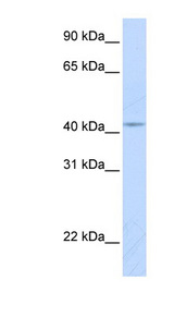 COX10 antibody LS-C102158 Western blot of Fetal Lung lysate.