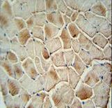 COX10 antibody immunohistochemistry of formalin-fixed and paraffin-embedded human skeletal muscle followed by peroxidase-conjugated secondary antibody and DAB staining.