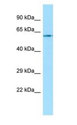 CHRM1 / M1 antibody Western Blot of Fetal Bladder.