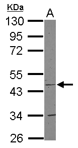 Sample (30 ug of whole cell lysate) A: Jurkat 10% SDS PAGE COX15 antibody diluted at 1:1000