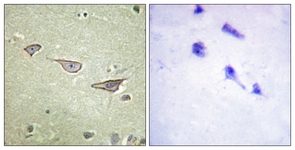 IHC of paraffin-embedded human brain tissue, using COX15 Antibody. The sample on the right was incubated with synthetic peptide.
