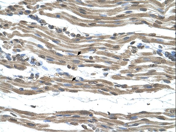 COX15 antibody LS-C80893 was used in IHC to stain formalin-fixed, paraffin-embedded human muscle.