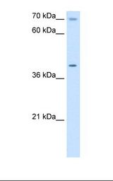 HepG2 cell lysate. Antibody concentration: 5.0 ug/ml. Gel concentration: 12%.