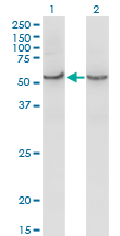 Western Blot analysis of COX15 expression in transfected 293T cell line by COX15 monoclonal antibody (M01), clone 2D2.Lane 1: COX15 transfected lysate (Predicted MW: 46 KDa).Lane 2: Non-transfected lysate.