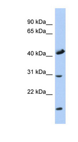 COX18 antibody LS-C102685 Western blot of Fetal Muscle lysate.