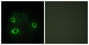 Immunofluorescence of COS7 cells, using COX42 Antibody. The picture on the right is treated with the synthesized peptide.