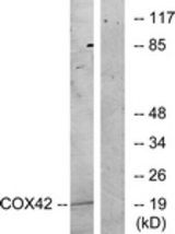 Western blot of extracts from K562 cells, treated with insulin 0.01U/ml 15', using COX42 Antibody. The lane on the right is treated with the synthesized peptide.