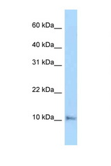 COX6A1 antibody LS-C146087 Western blot of Mouse Heart lysate. Antibody concentration 1 ug/ml.