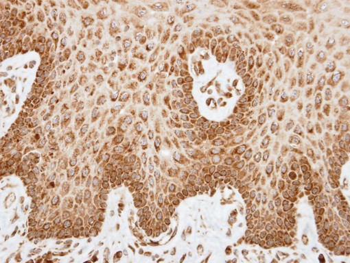 IHC of paraffin-embedded SCC4 xenograft using COX6A2 antibody at 1:100 dilution.
