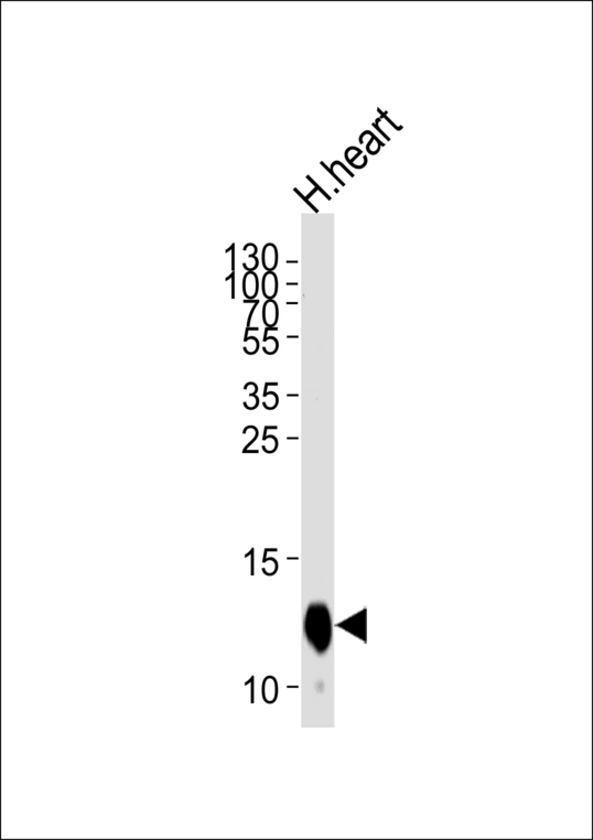Western blot of lysate from human heart tissue lysate, using COX6A2 Antibody. Antibody was diluted at 1:1000 at each lane. A goat anti-rabbit IgG H&L (HRP) at 1:5000 dilution was used as the secondary antibody. Lysate at 35ug per lane.