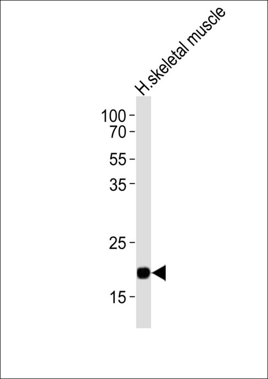 Western blot of lysate from human skeletal muscle tissue lysate, using COX6A2 Antibody. Antibody was diluted at 1:1000. A goat anti-rabbit IgG H&L (HRP) at 1:10000 dilution was used as the secondary antibody. Lysate at 20ug.