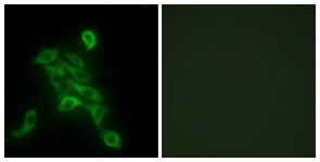 Immunofluorescence of HepG2 cells, using COX6C Antibody. The picture on the right is treated with the synthesized peptide.
