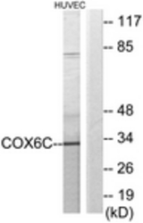 Western blot of extracts from HUVEC cells, using COX6C Antibody. The lane on the right is treated with the synthesized peptide.