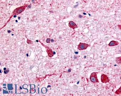 Anti-CHRM2 antibody LS-A1331 IHC of human brain, neurons and glia. Immunohistochemistry of formalin-fixed, paraffin-embedded tissue after heat-induced antigen retrieval.