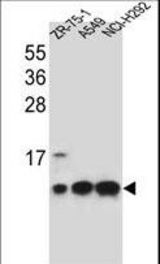 COX6B1 Antibody western blot of ZR-75-1,A549,NCI-H292 cell line lysates (35 ug/lane). The COX6B1 antibody detected the COX6B1 protein (arrow).