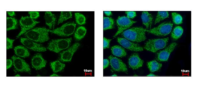 COX6B1 antibody [N2C3] detects COX6B1 protein at mitochondria by immunofluorescent analysis. A431 cells were fixed in 4% paraformaldehyde at RT for 15 min. COX6B1 protein stained by COX6B1 antibody [N2C3] diluted at 1:500. 