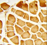 Formalin-fixed and paraffin-embedded human skeletal muscle reacted with COX4I1 Antibody , which was peroxidase-conjugated to the secondary antibody, followed by DAB staining. This data demonstrates the use of this antibody for immunohistochemistry; clinical relevance has not been evaluated.