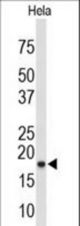 Western blot of COX4I1 Antibody in HeLa cell line lysates (35 ug/lane). COX4I1 (arrow) was detected using the purified antibody.