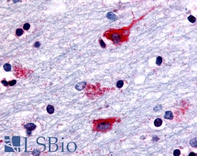 Anti-CHRM2 antibody LS-A1333 IHC of human brain, neurons and glia. Immunohistochemistry of formalin-fixed, paraffin-embedded tissue after heat-induced antigen retrieval.