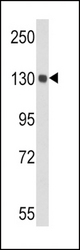 Western blot of CP Antibody in mouse lung tissue lysates (35 ug/lane). CP (arrow) was detected using the purified antibody.