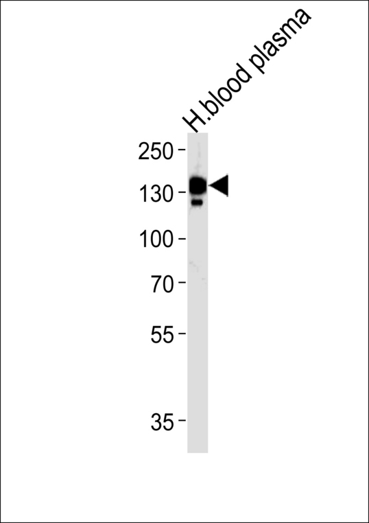 CP Antibody western blot of human blood plasma tissue lysates (35 ug/lane). The CP antibody detected the CP protein (arrow).