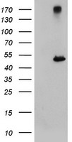 HEK293T cells were transfected with the pCMV6-ENTRY control (Left lane) or pCMV6-ENTRY CPA1 (Right lane) cDNA for 48 hrs and lysed. Equivalent amounts of cell lysates (5 ug per lane) were separated by SDS-PAGE and immunoblotted with anti-CPA1.