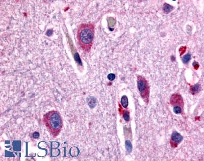Anti-CHRM2 antibody LS-A1330 IHC of human brain, neurons and glia. Immunohistochemistry of formalin-fixed, paraffin-embedded tissue after heat-induced antigen retrieval.