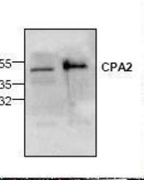 Western blot of CPA2 antibody LS-C48735.