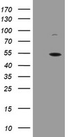 HEK293T cells were transfected with the pCMV6-ENTRY control (Left lane) or pCMV6-ENTRY CPA2 (Right lane) cDNA for 48 hrs and lysed. Equivalent amounts of cell lysates (5 ug per lane) were separated by SDS-PAGE and immunoblotted with anti-CPA2.