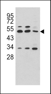 Western blot of CPA4 antibody in HeLa, CEM and NCI-H460 cell line lysates (35 ug/lane). CPA4 (arrow) was detected using the purified antibody.