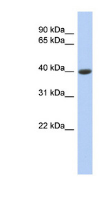 CPB1 / Carboxypeptidase B antibody LS-C109838 Western blot of COLO205 cell lysate.