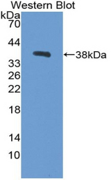 Western blot of recombinant CPB / Carboxypeptidase B.