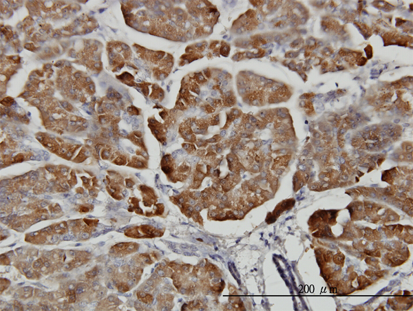 Immunoperoxidase of monoclonal antibody to CPB1 on formalin-fixed paraffin-embedded human pancreas. [antibody concentration 3 ug/ml]