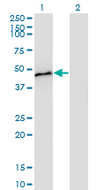 Western blot of CPB1 expression in transfected 293T cell line by CPB1 monoclonal antibody (M01), clone 4D5.