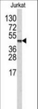Western blot of CPB2 antibody (Center E134) in Jurkat cell line lysates (35 ug/lane). CPB2 (arrow) was detected using the purified antibody.